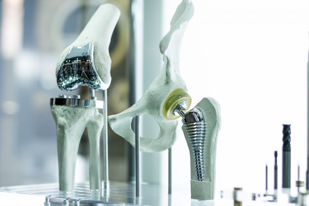 total knee replacement hip replacement models sitting on table