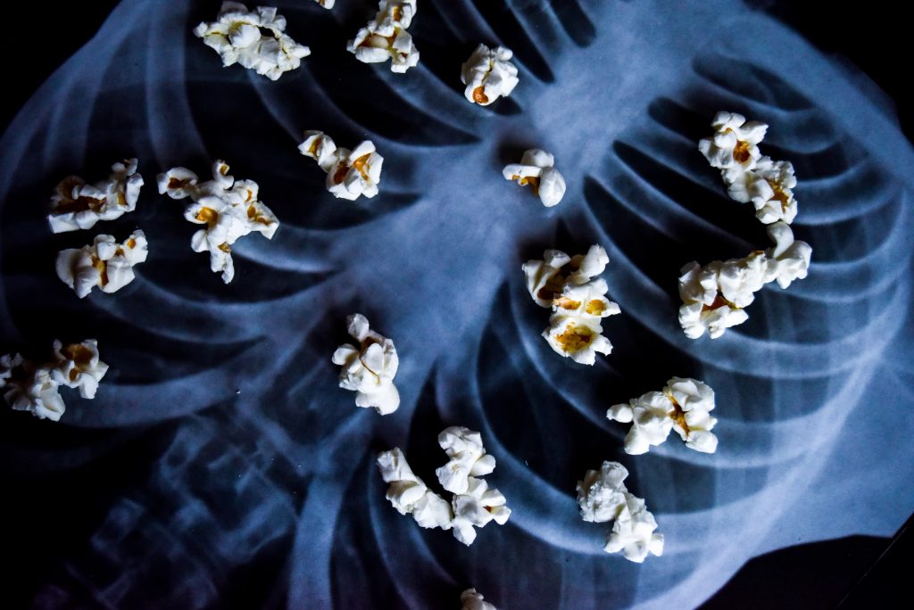 popcorn laying on top of chest x-ray to symbolize popcorn lung vaping smoking hazard when you get sick from vaping